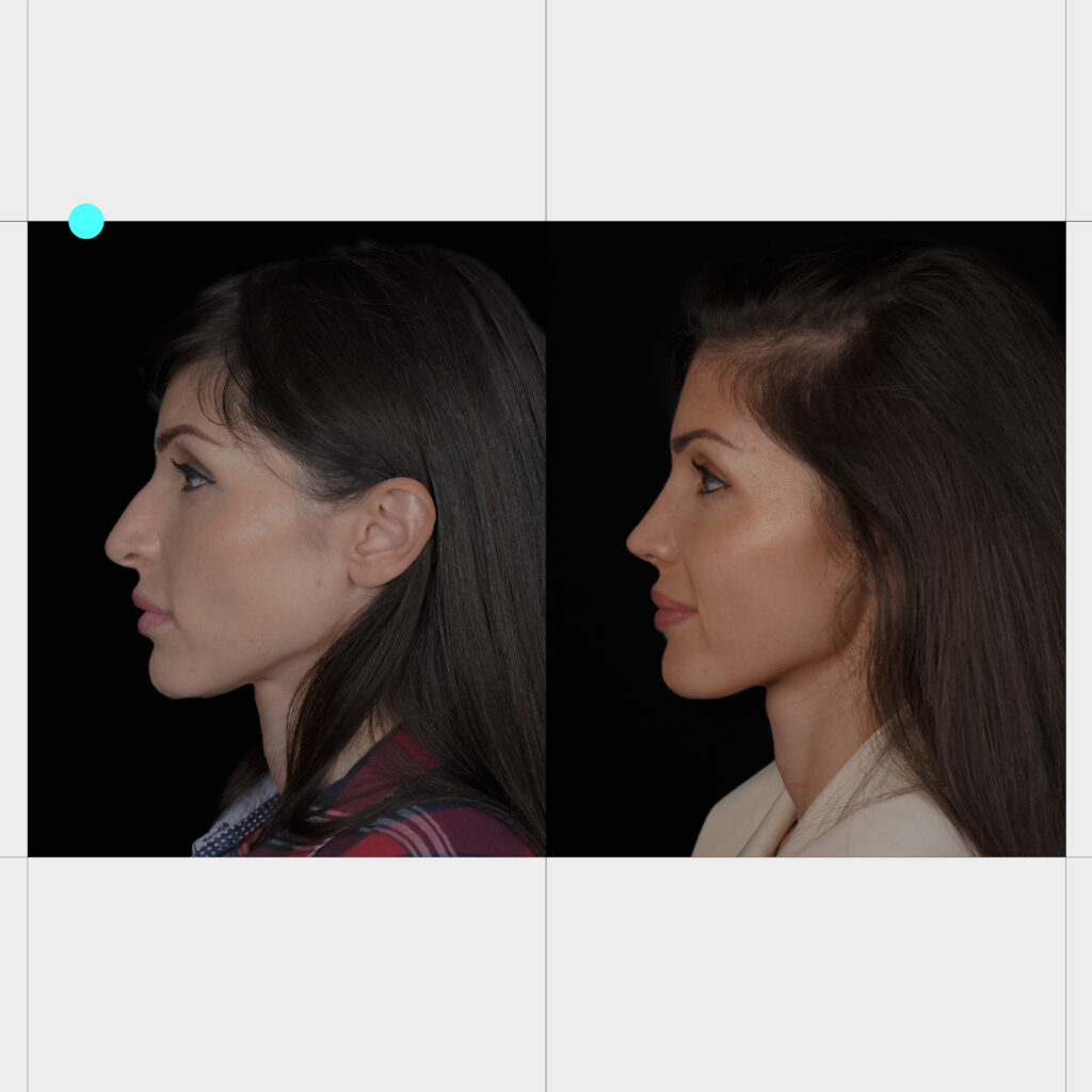 Post V2 Caso Diego RF Ancar 2025 09 1