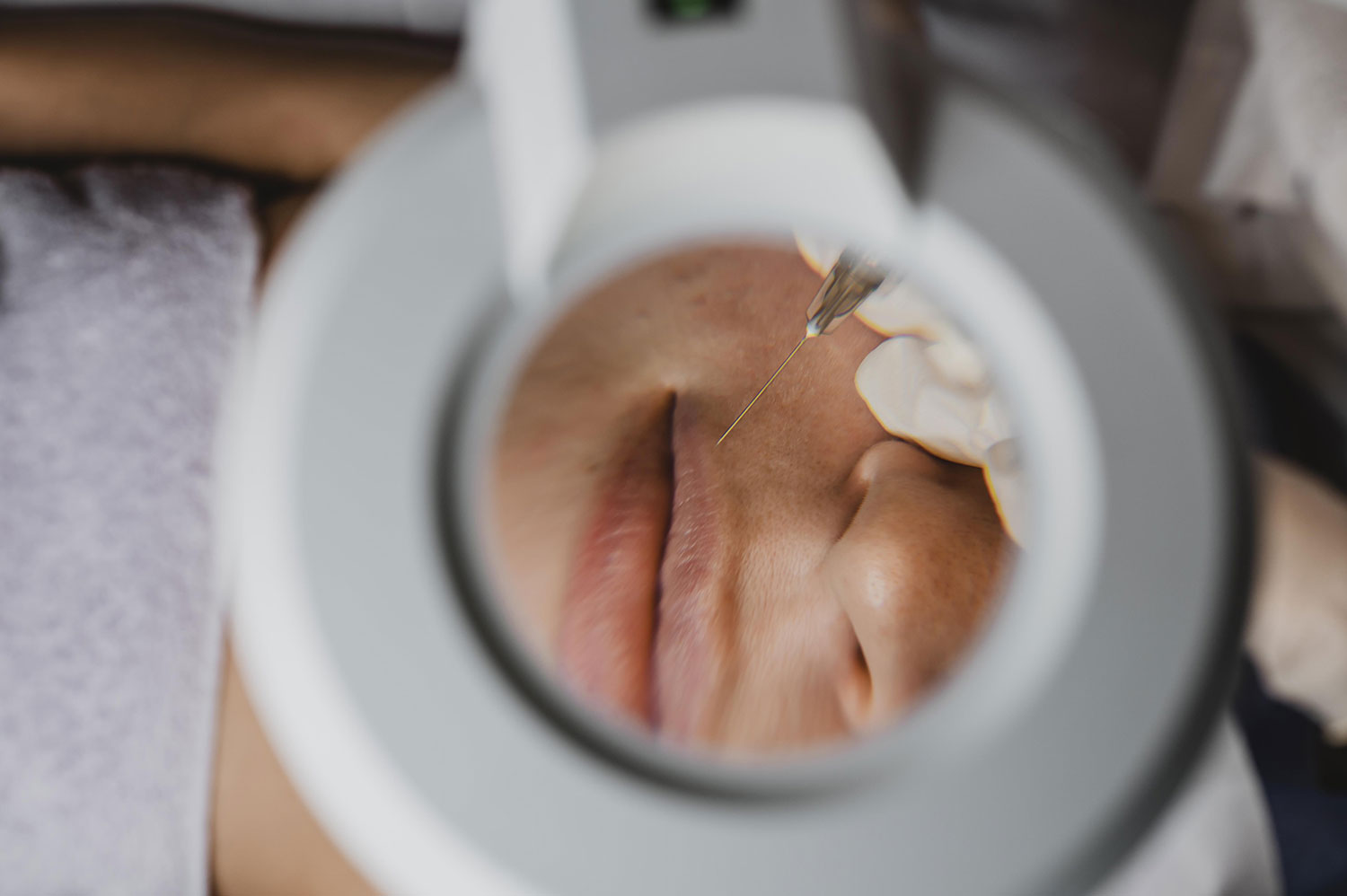 rhinoandface tratamientos 1