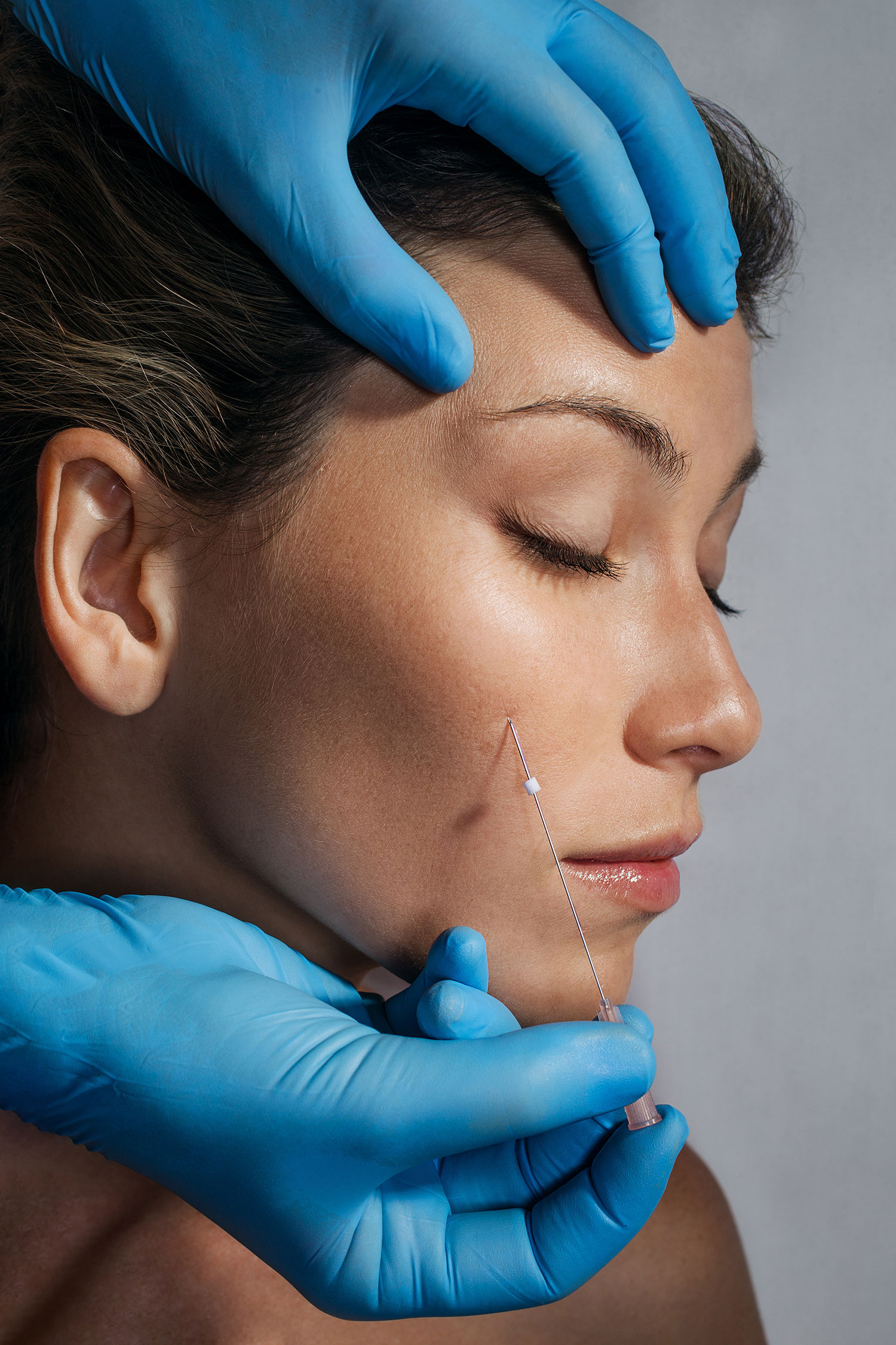 rhinoandface tratamientos 8